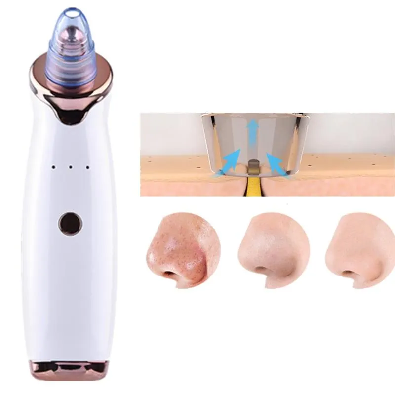 Blackhead Vacuum Remover Electric Pore Cleaner